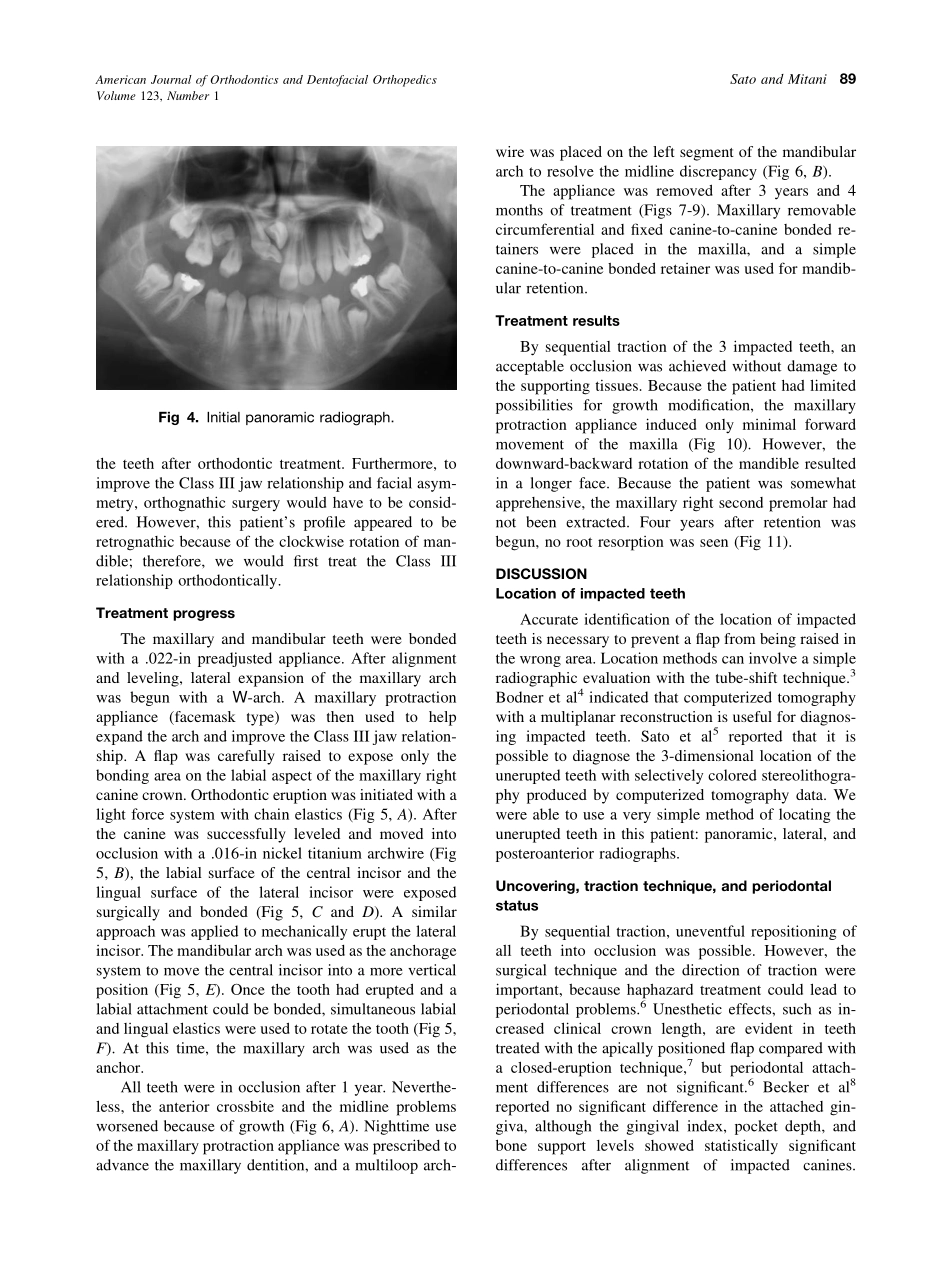 2003_123_1_87_92_Sato.pdf_第3页