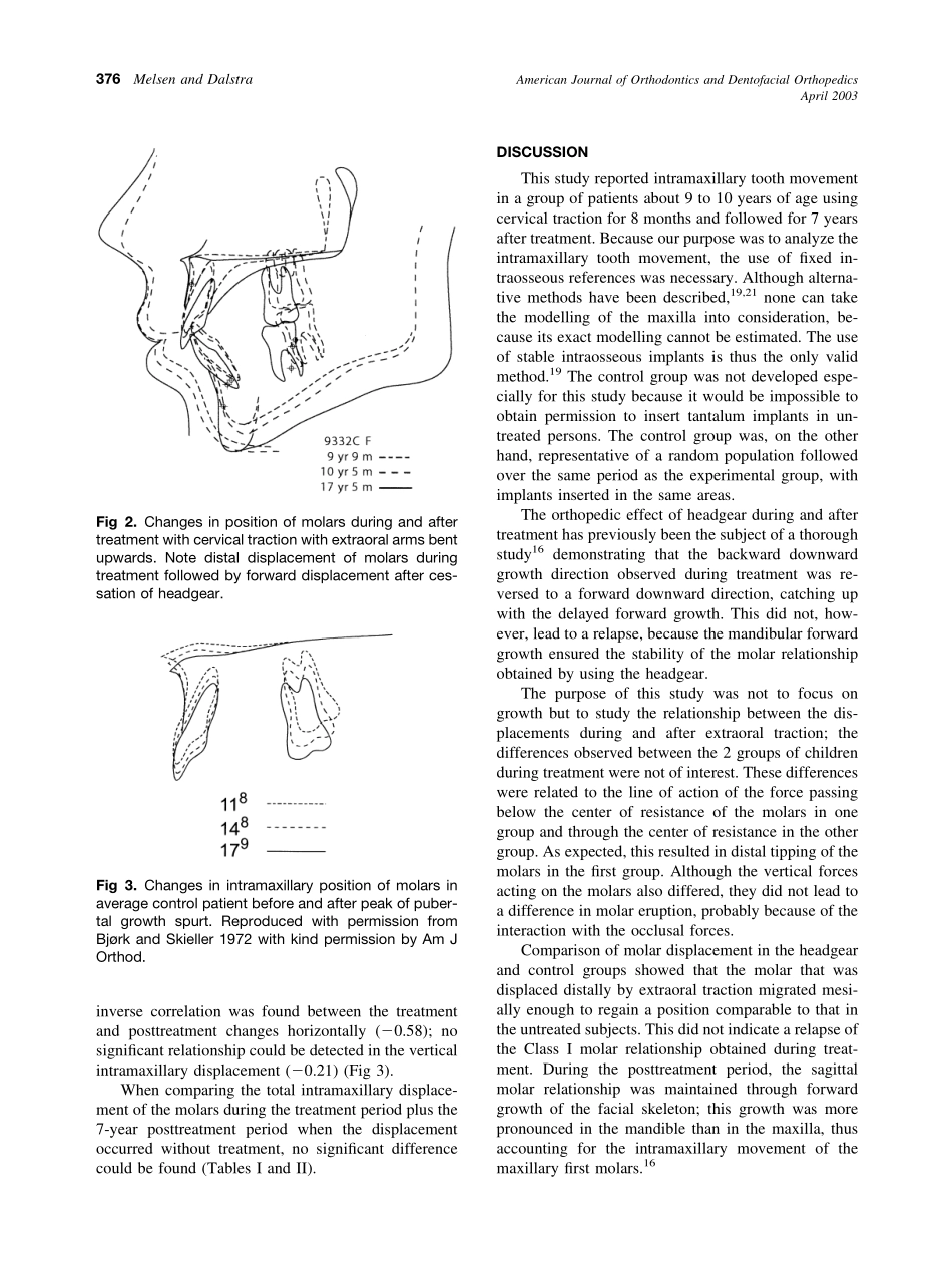 2003_123_4_374_378_Melsen.pdf_第3页