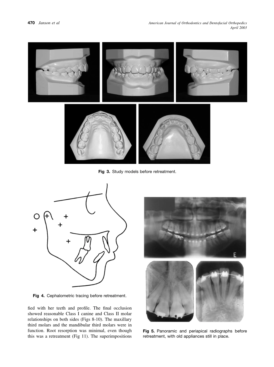 2003_123_4_468_475_Janson.pdf_第3页