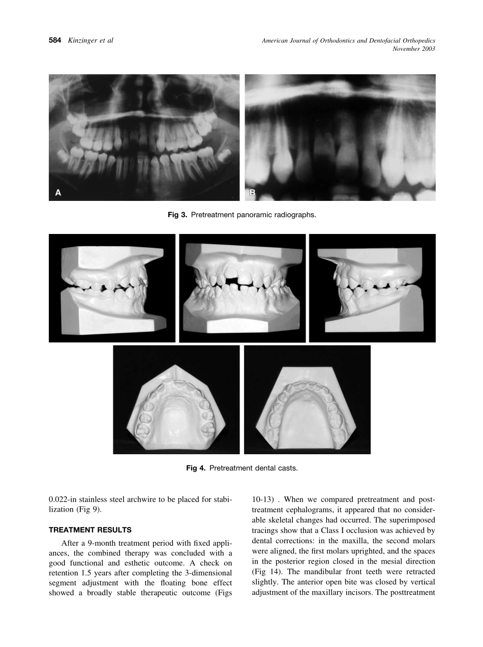 2003_124_5_582_590_Kinzinger.pdf_第3页