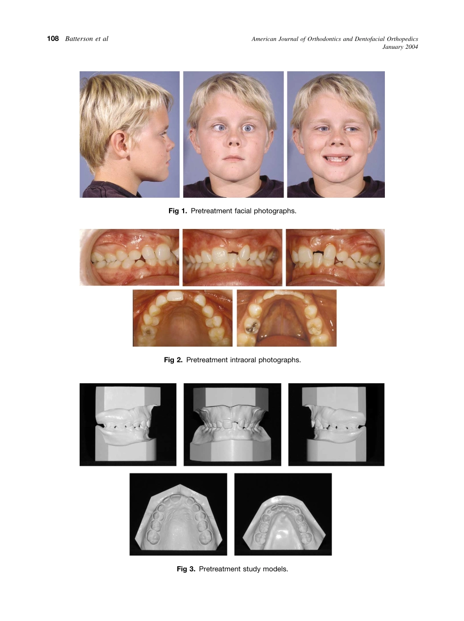 2004_125_1_107_114_Batterson.pdf_第2页