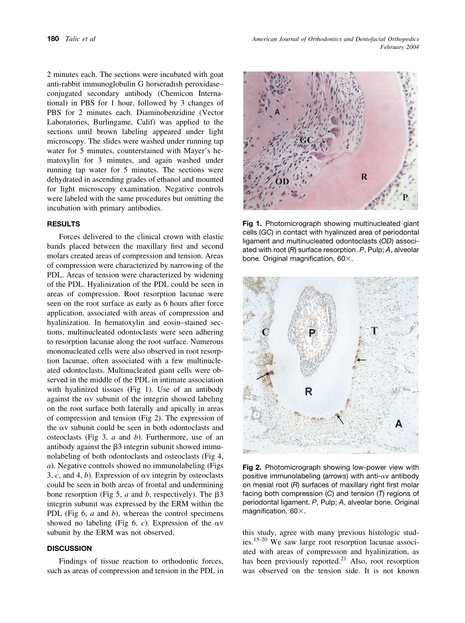 2004_125_2_178_184_Talic.pdf_第3页