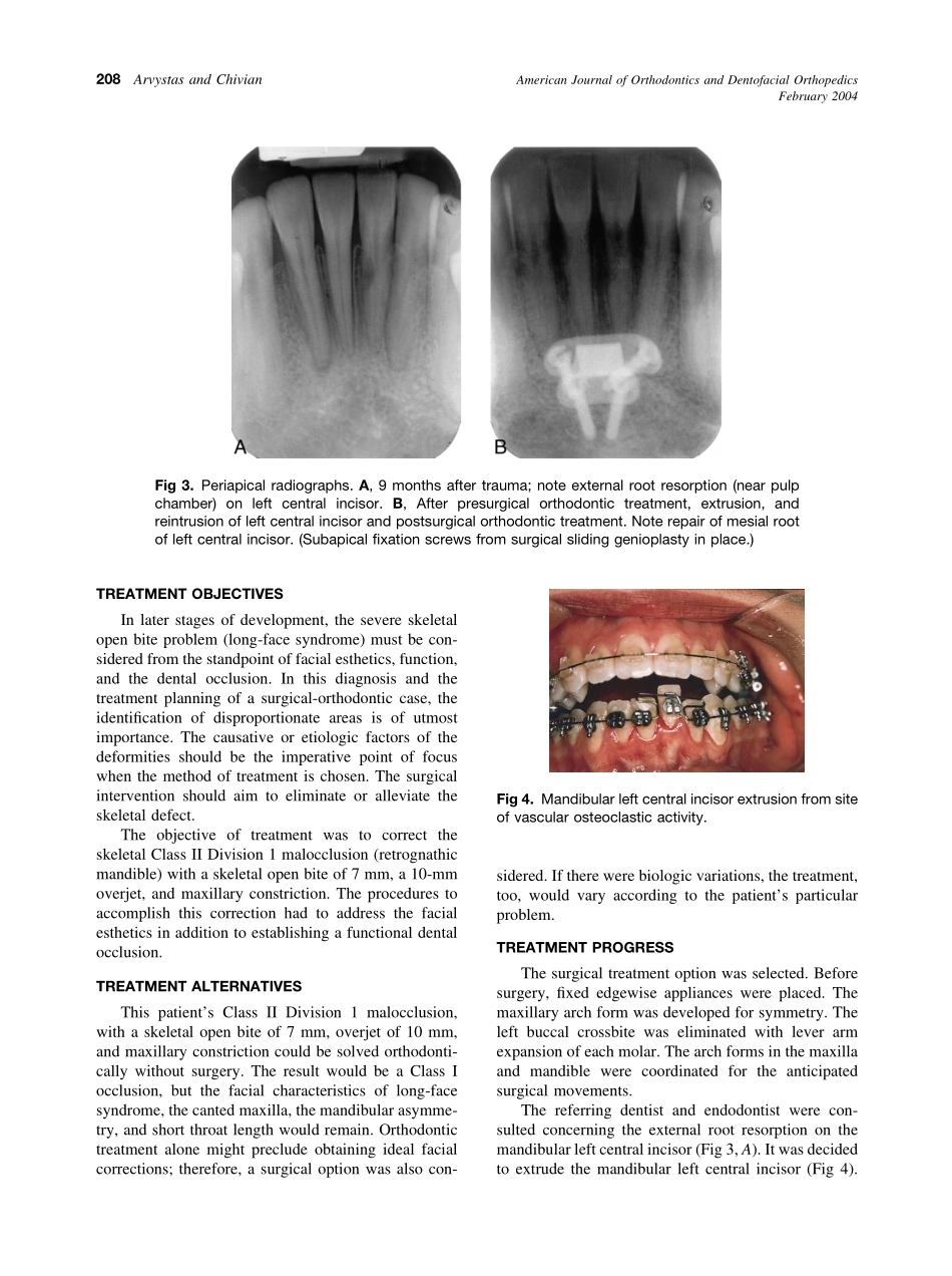 2004_125_2_206_212_Arvystas.pdf_第3页