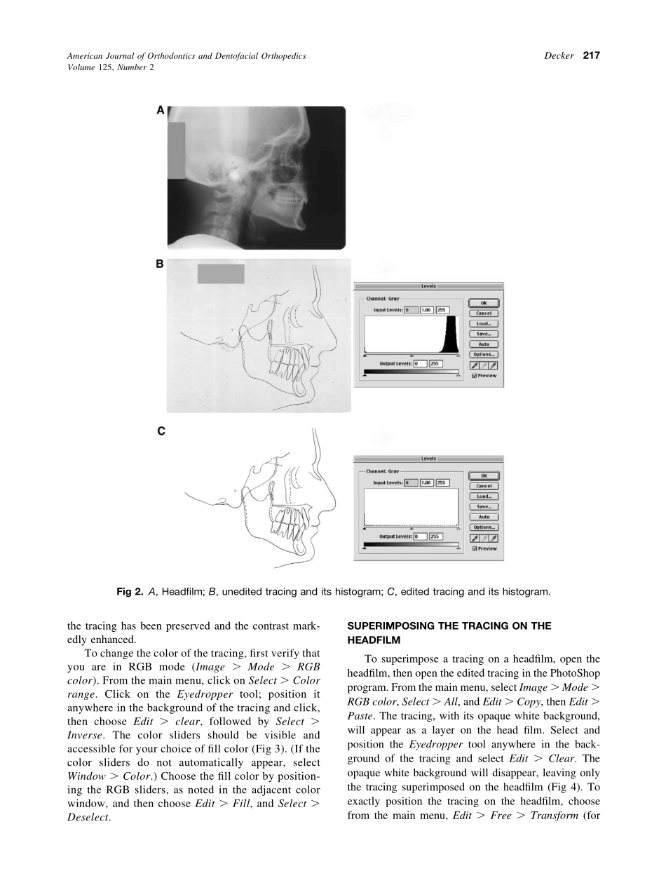 2004_125_2_215_219_Decker.pdf_第3页