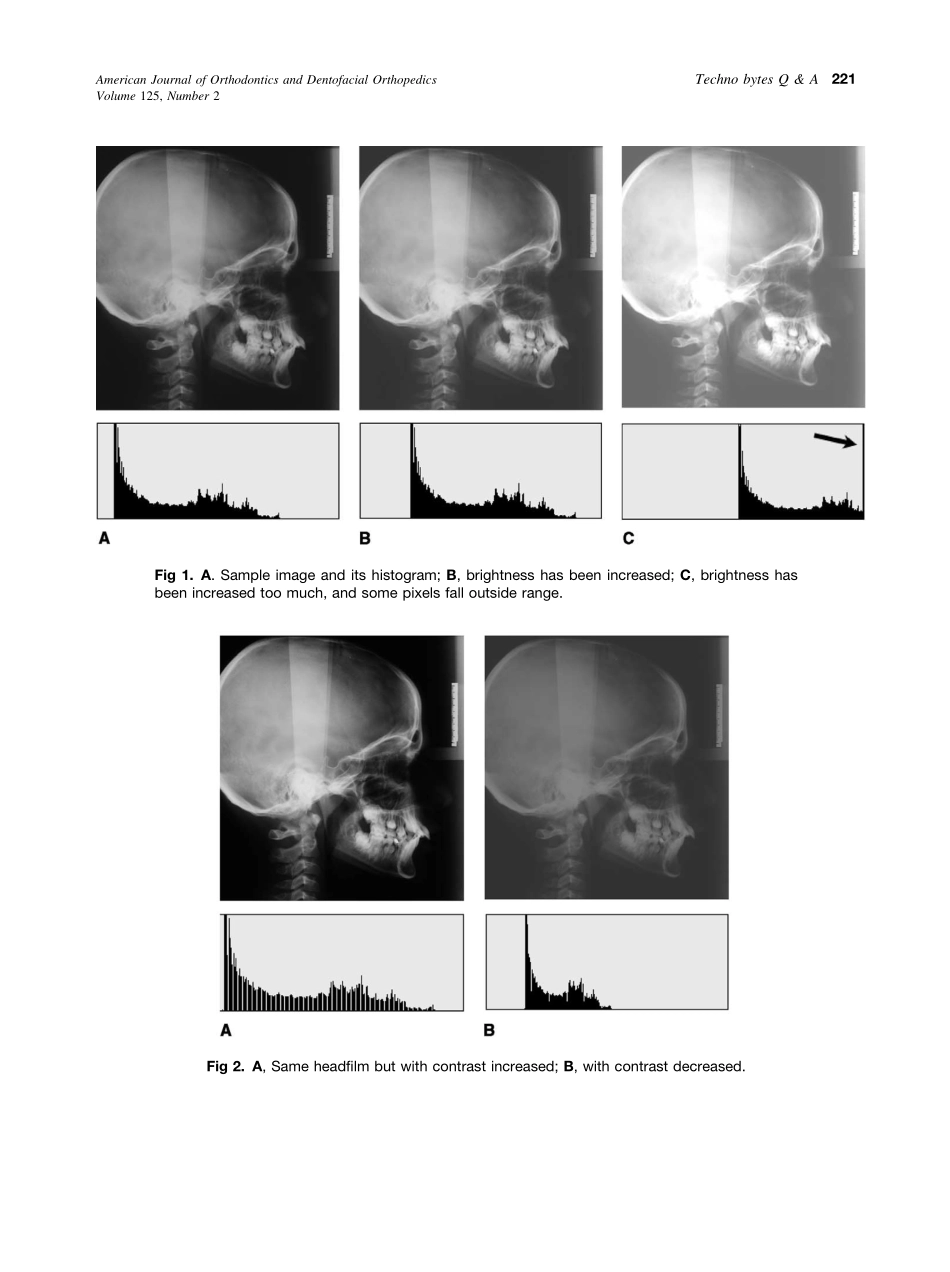 2004_125_2_220_222_Halazonetis.pdf_第2页