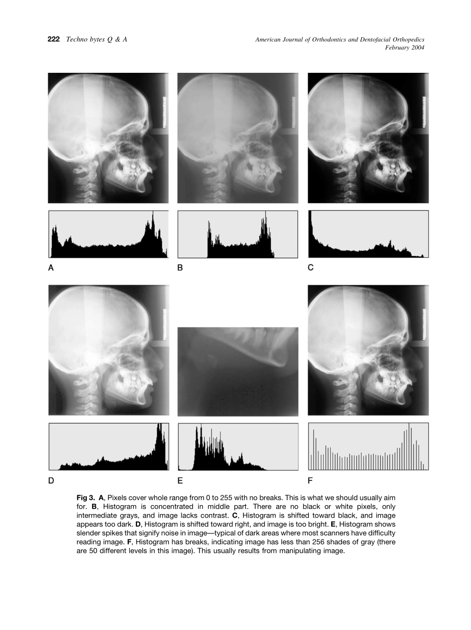 2004_125_2_220_222_Halazonetis.pdf_第3页