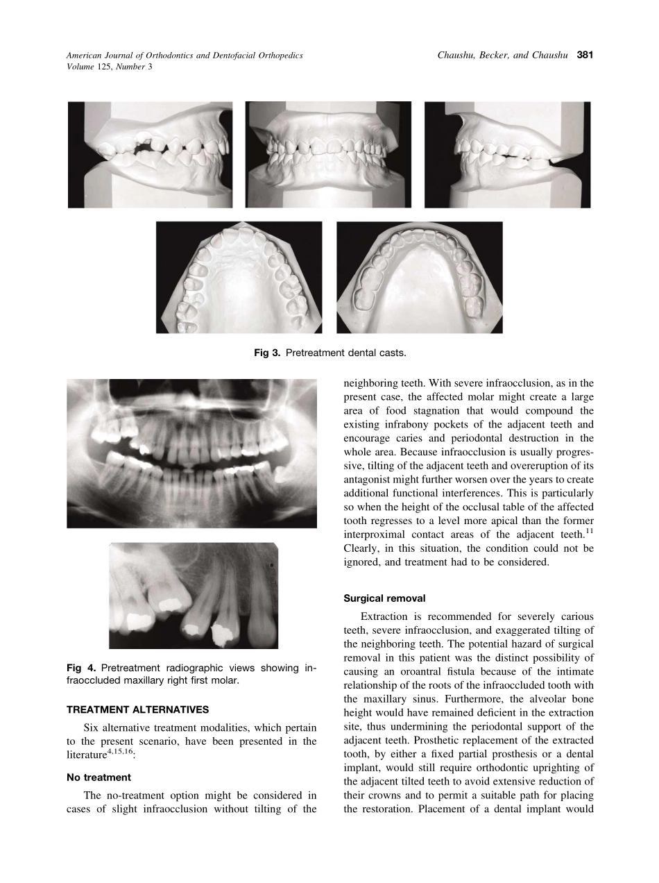 2004_125_3_379_387_Chaushu.pdf_第3页