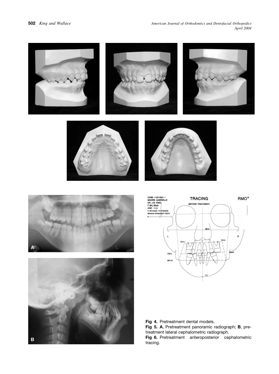 2004_125_4_500_509_King.pdf_第3页