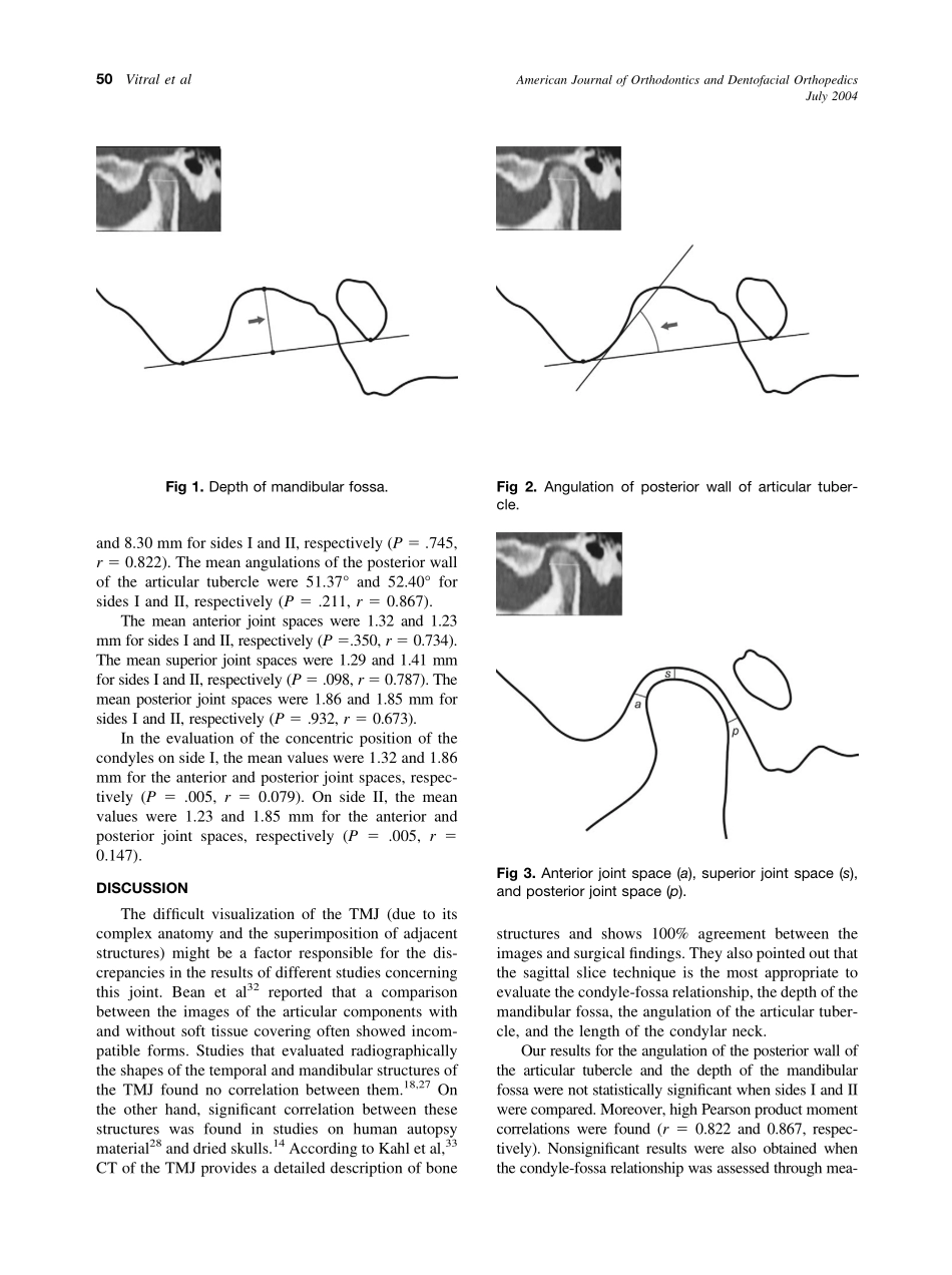 2004_126_1_48_52_Vitral.pdf_第3页