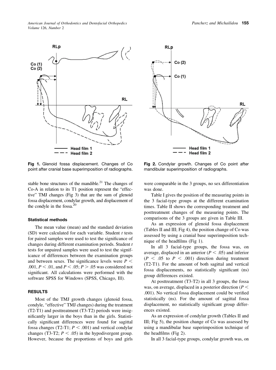 2004_126_2_153_161_Pancherz.pdf_第3页