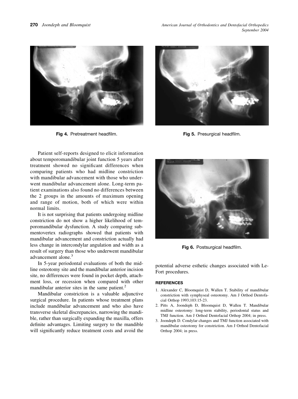 2004_126_3_268_270_Joondeph.pdf_第3页