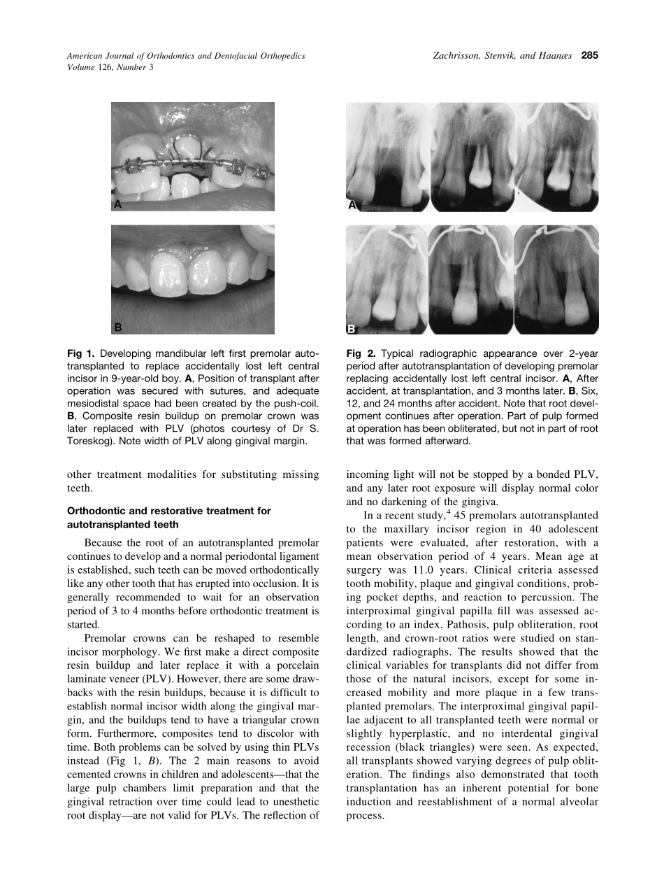 2004_126_3_284_288_Zachrisson.pdf_第2页