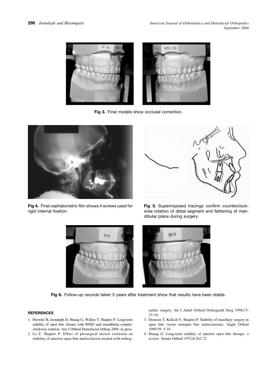 2004_126_3_296_298_Joondeph.pdf_第3页