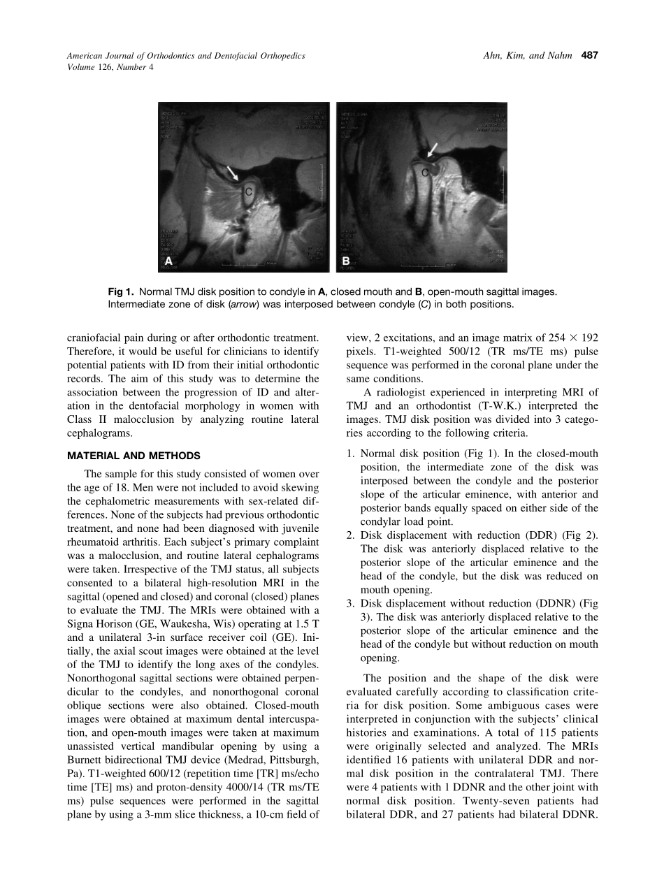 2004_126_4_485_493_Ahn.pdf_第2页