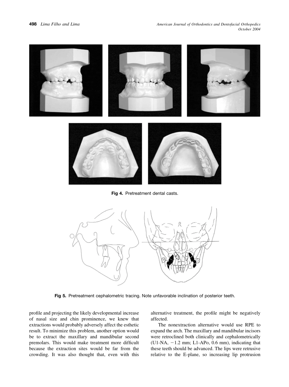 2004_126_4_495_504_Filho.pdf_第3页