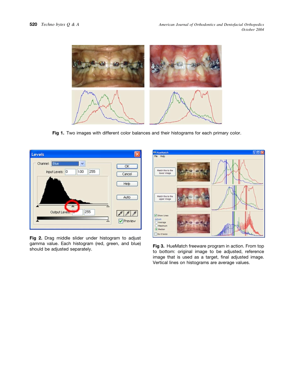 2004_126_4_518_519_Halazonetis.pdf_第2页