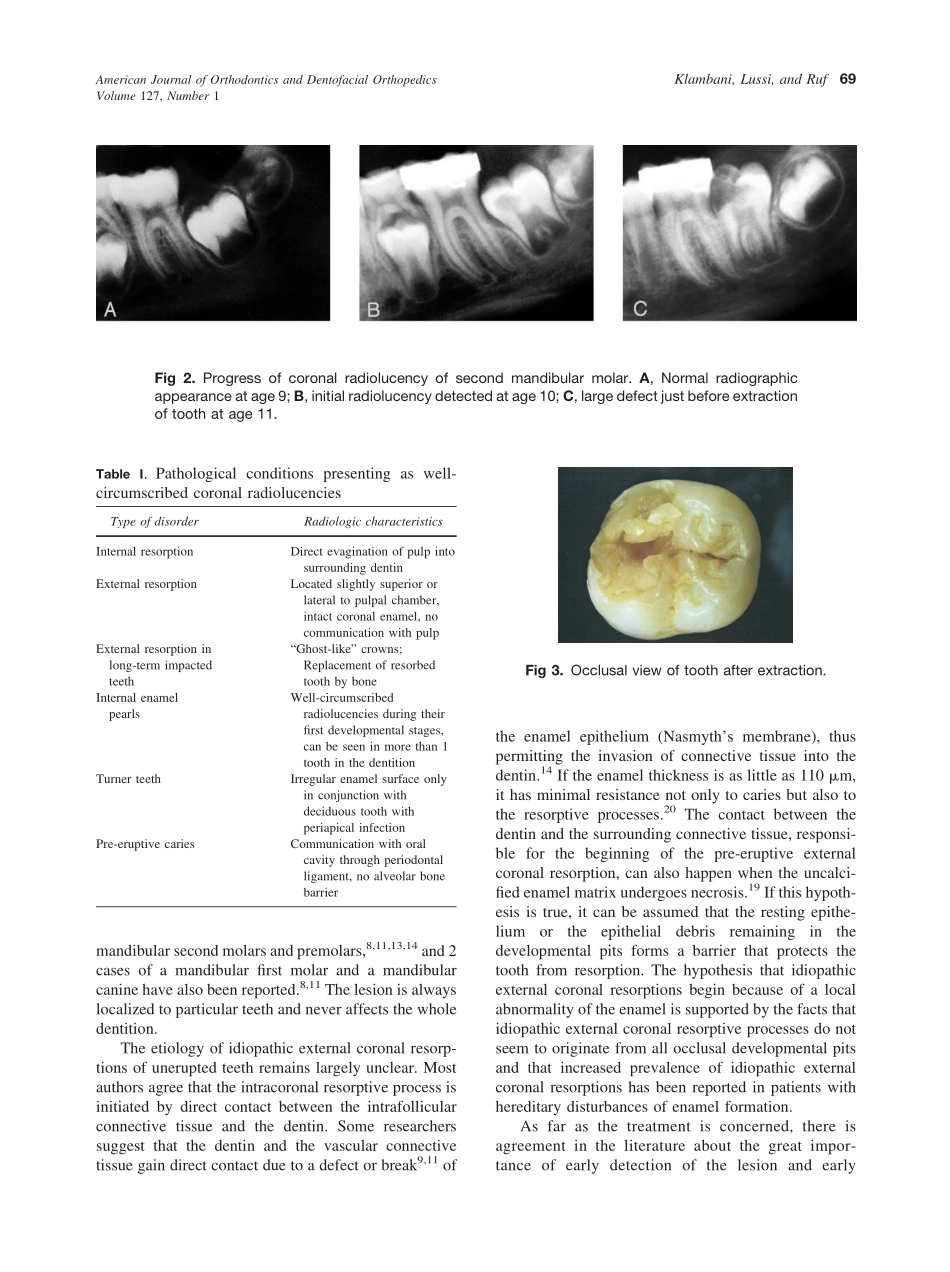 2005_127_1_67_71_Klambani.pdf_第3页