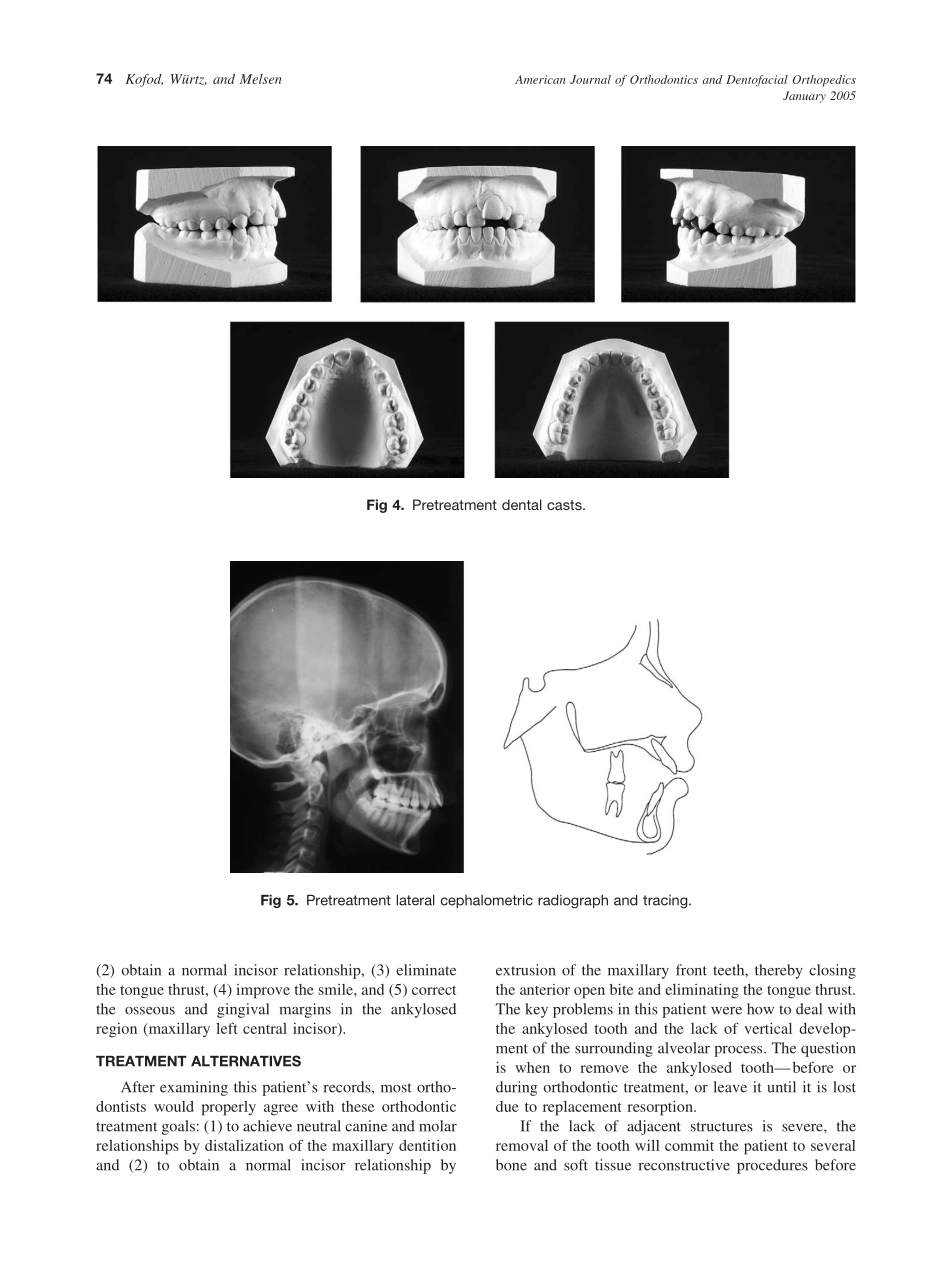 2005_127_1_72_80_Kofod.pdf_第3页