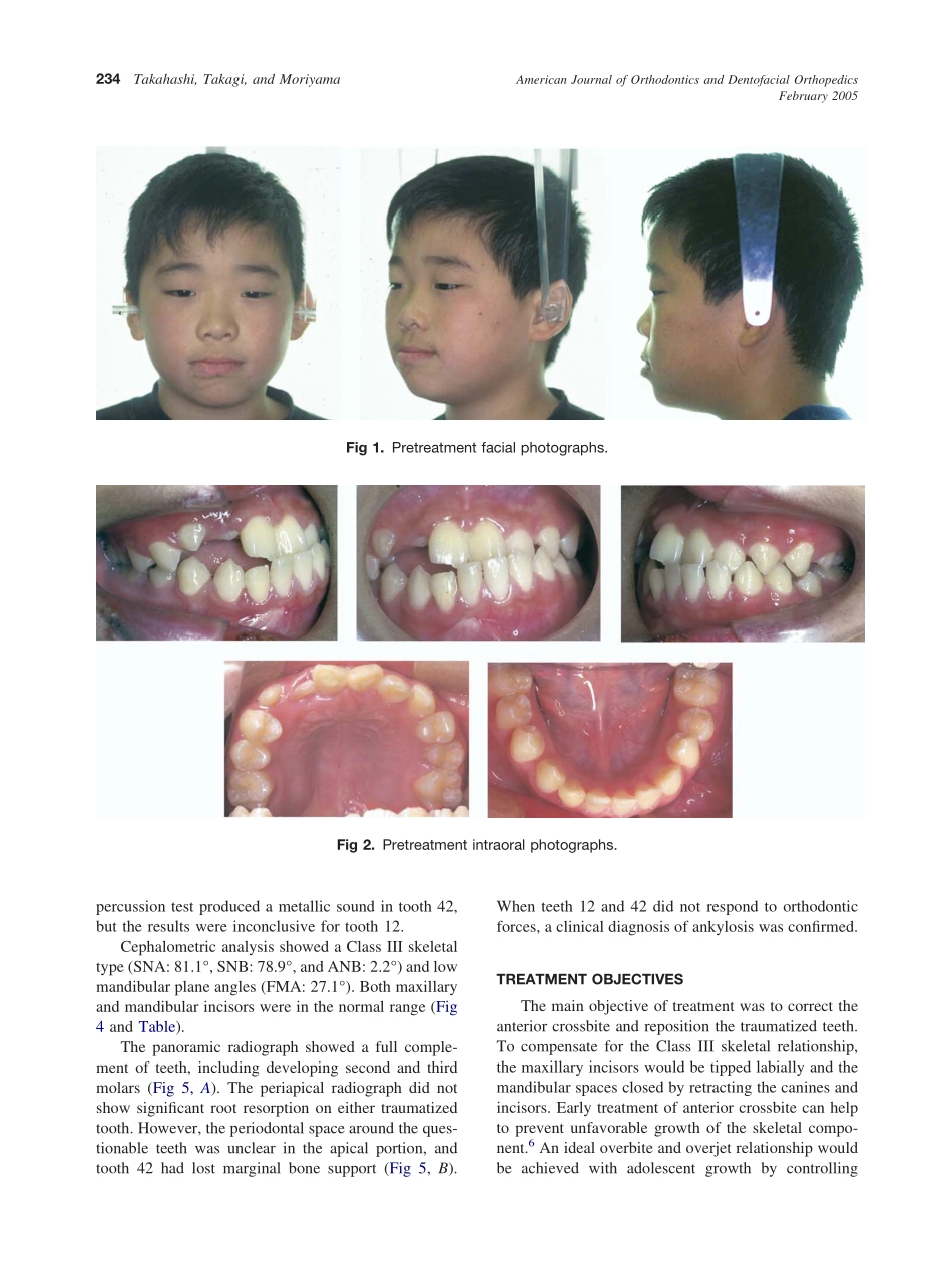2005_127_2_233_241_Takahashi.pdf_第2页