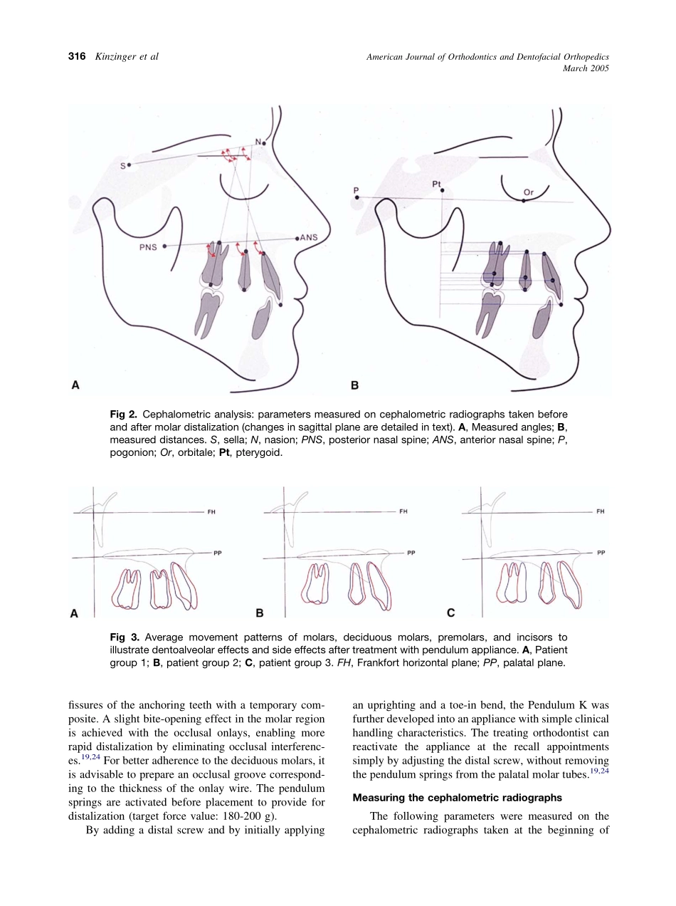 2005_127_3_314_323_Kinzinger.pdf_第3页