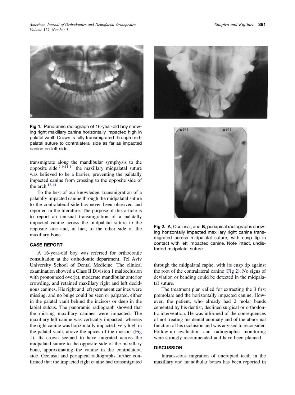 2005_127_3_360_363_Shapira.pdf_第2页