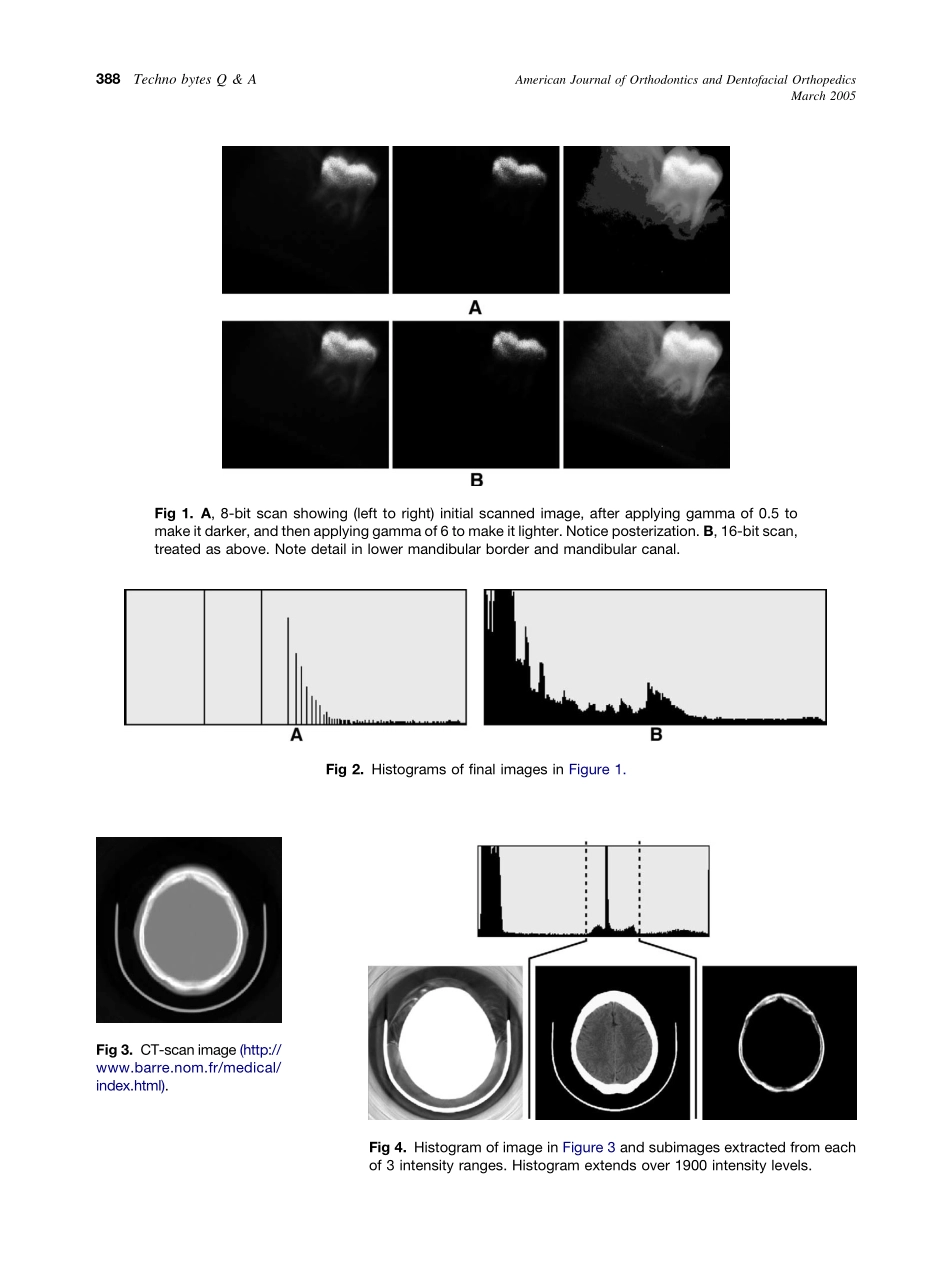 2005_127_3_387_388_Halazonetis.pdf_第2页