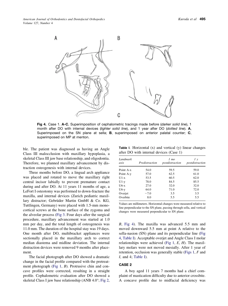 2005_127_4_493_498_Kuroda.pdf_第3页