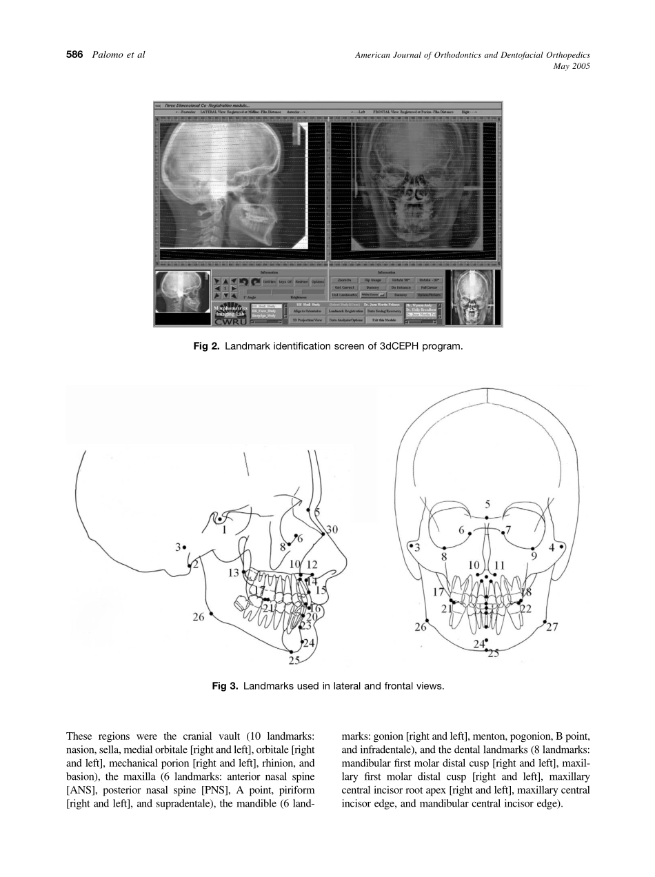 2005_127_5_584_591_Palomo.pdf_第3页