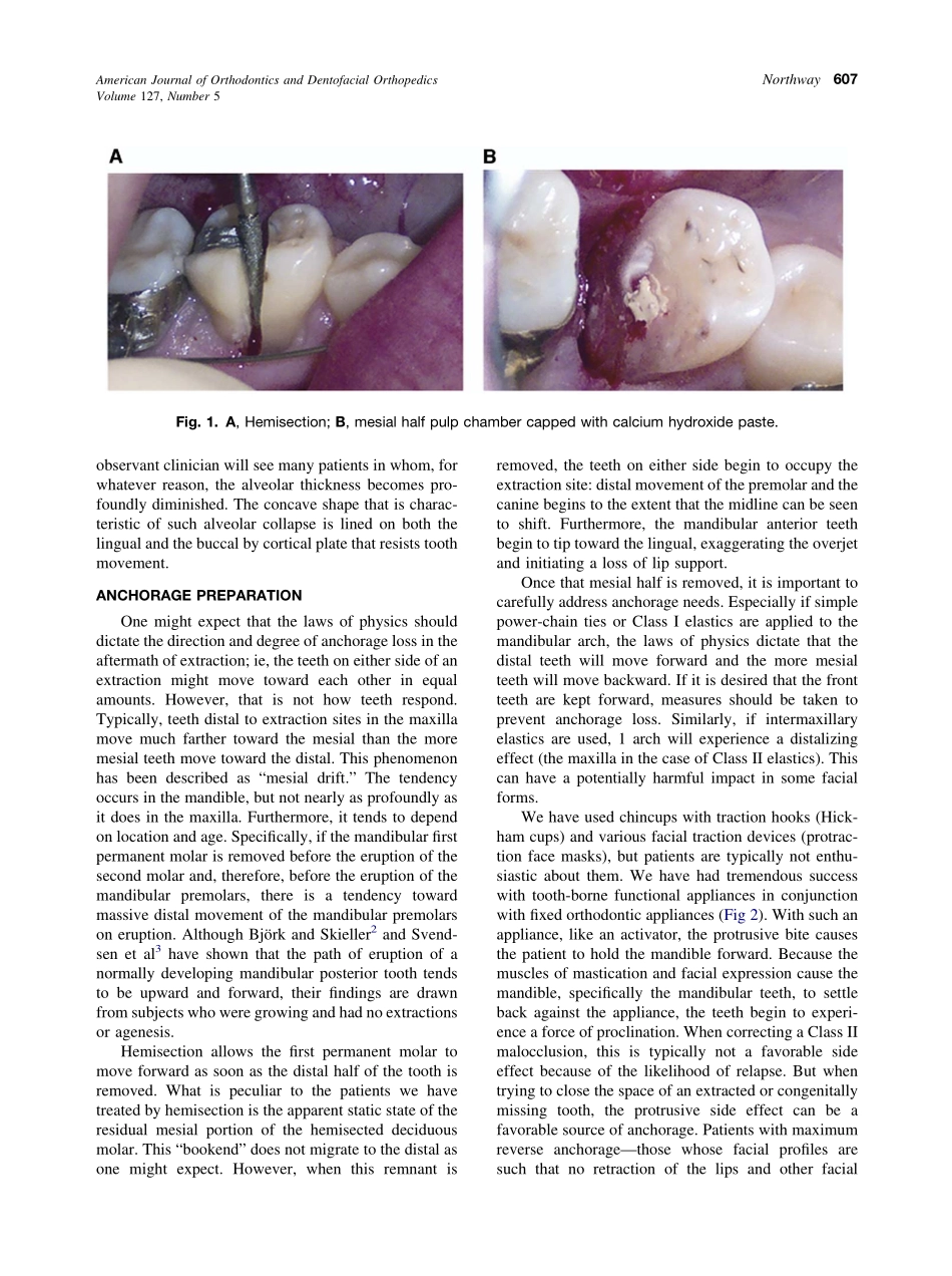 2005_127_5_606_610_Northway.pdf_第2页