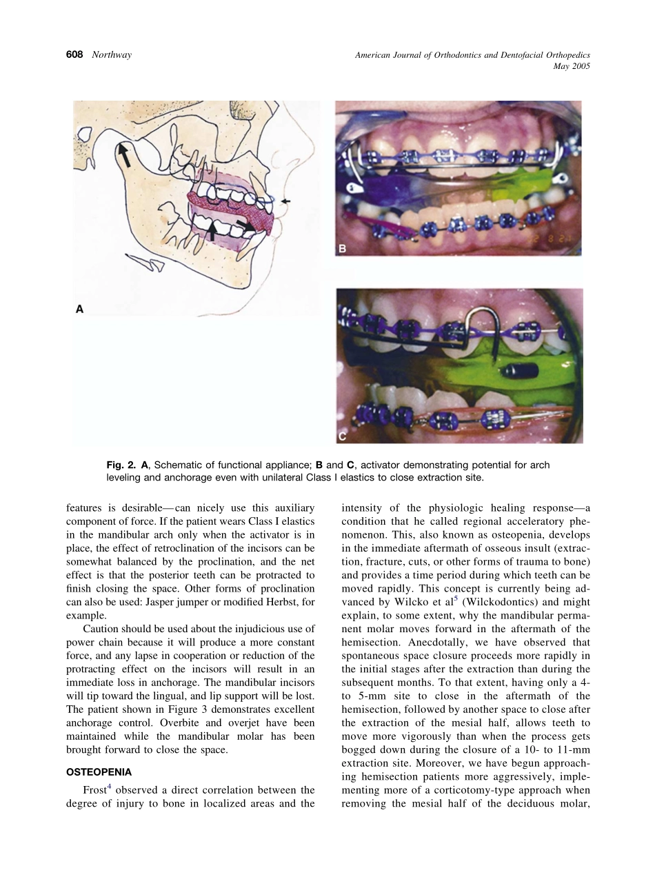 2005_127_5_606_610_Northway.pdf_第3页