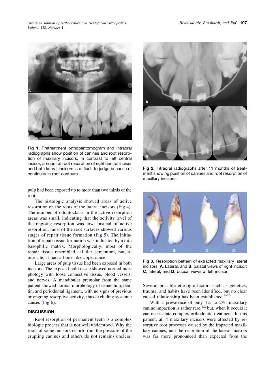 2005_128_1_106_109_Heimisdottir.pdf_第2页