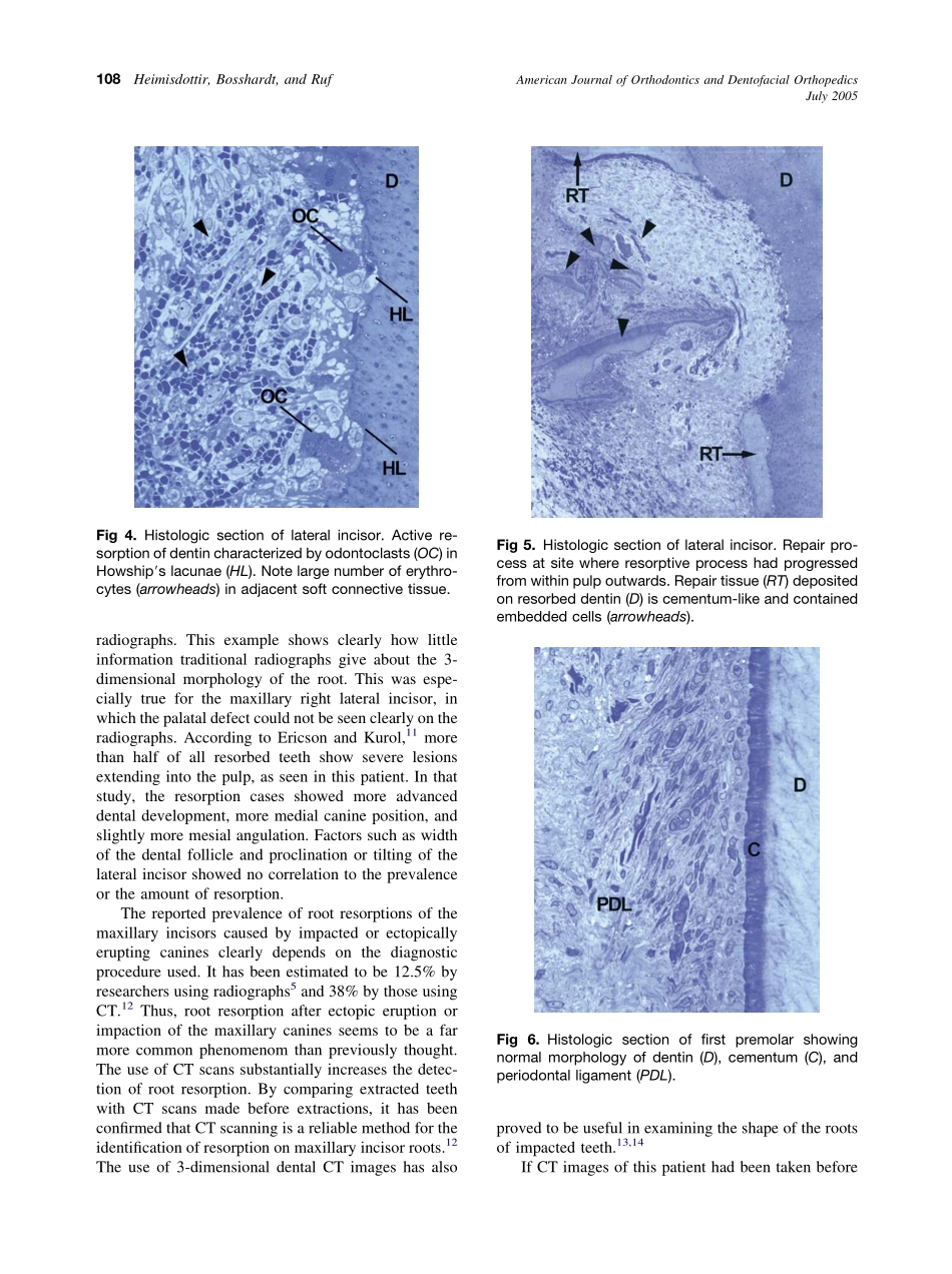 2005_128_1_106_109_Heimisdottir.pdf_第3页