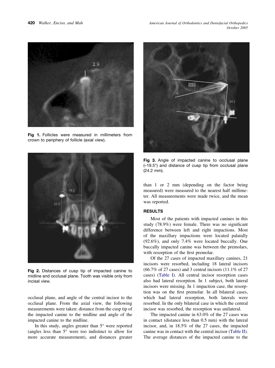 2005_128_4_418_423_Walker.pdf_第3页