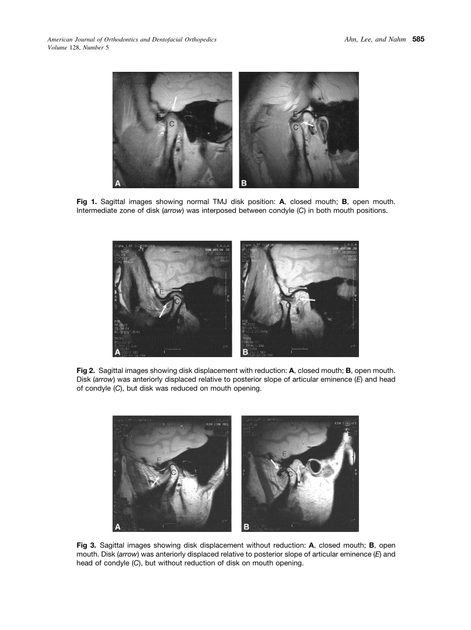 2005_128_5_583_591_Ahn.pdf_第3页