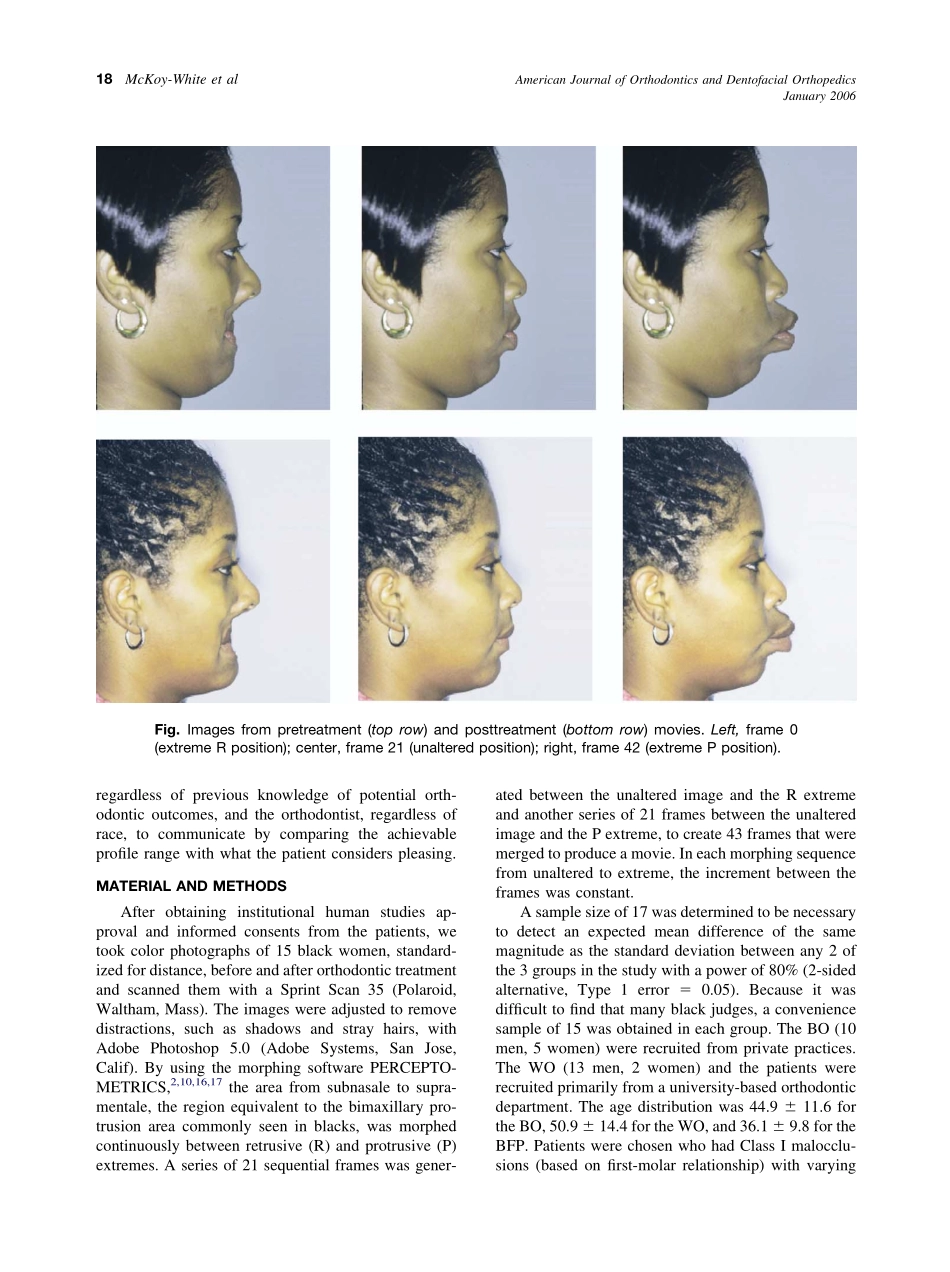 2006_129_1_17_23_McKoy-White.pdf_第2页