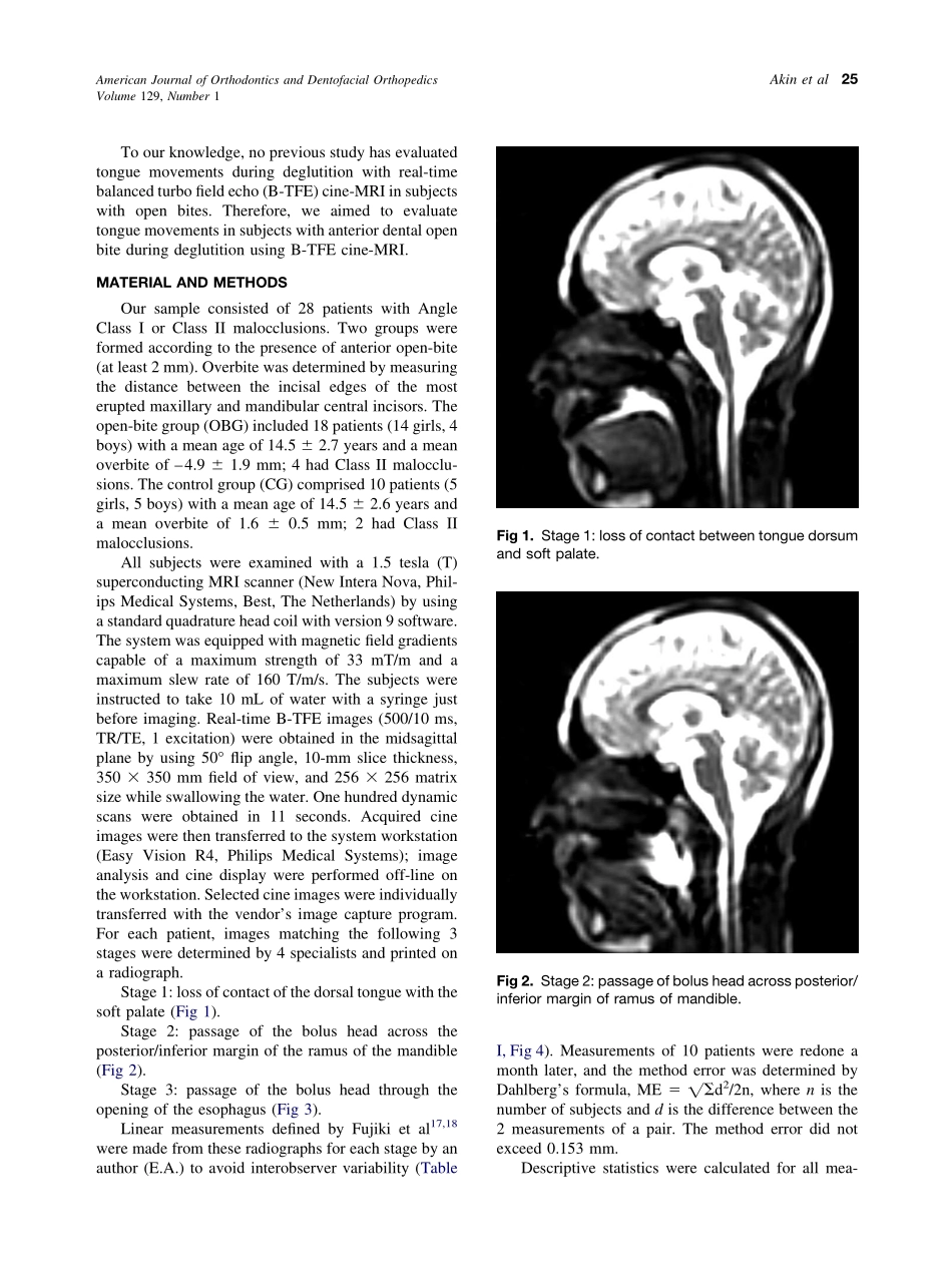 2006_129_1_24_28_Akin.pdf_第2页