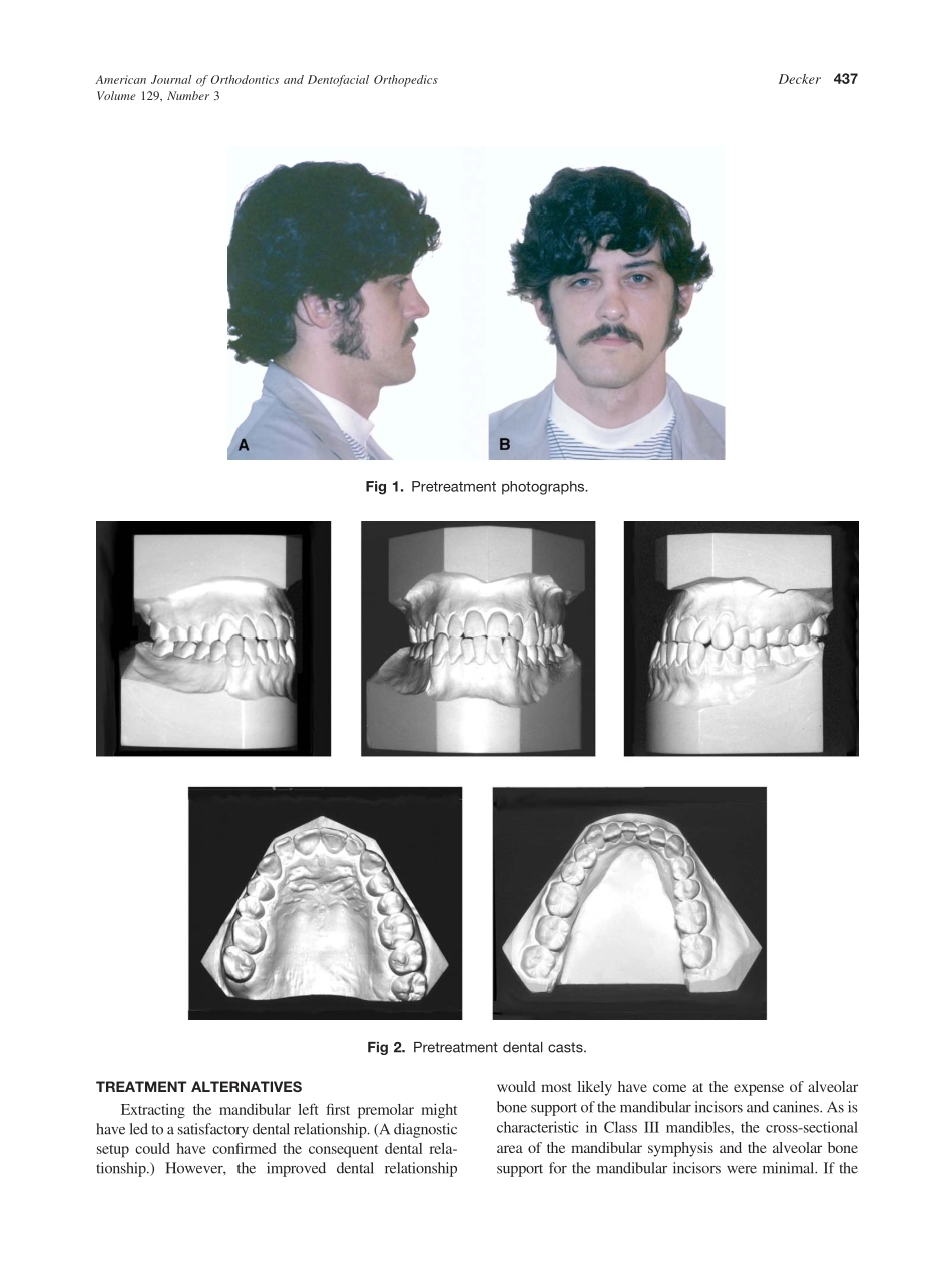 2006_129_3_436_443_Decker.pdf_第2页