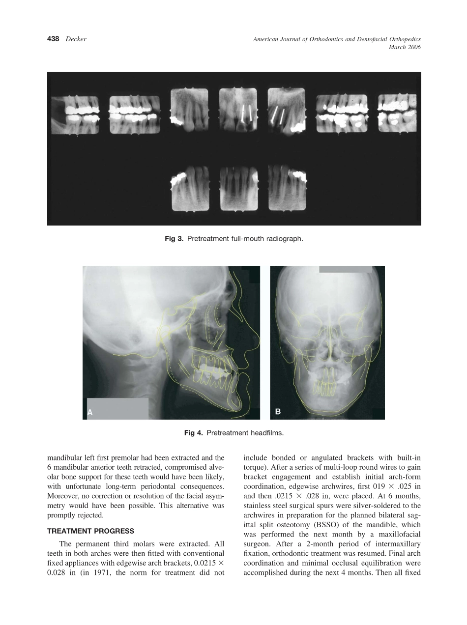 2006_129_3_436_443_Decker.pdf_第3页