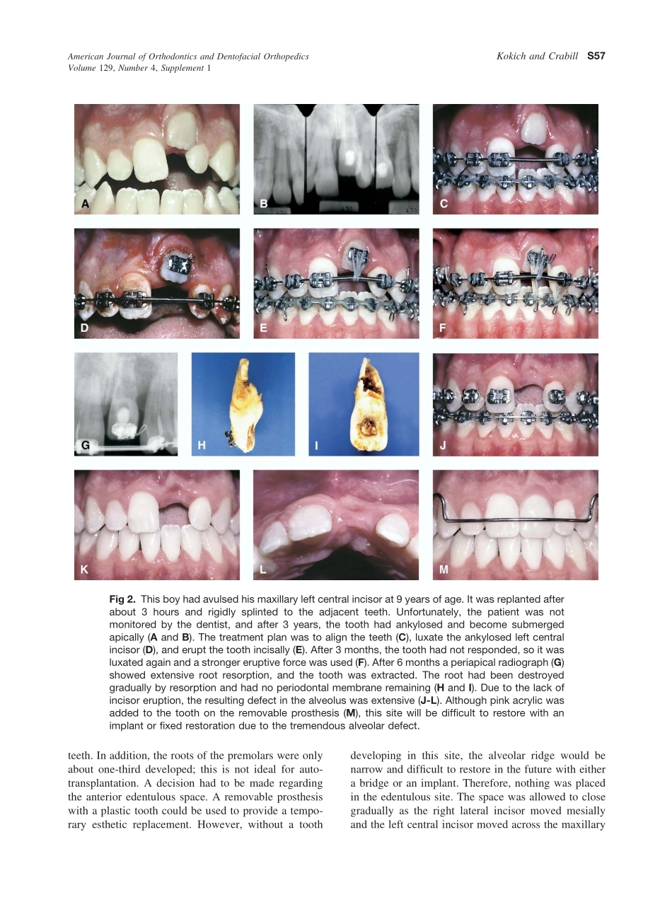 2006_129_4-Suppl-1_S55_S63_Kokich.pdf_第3页