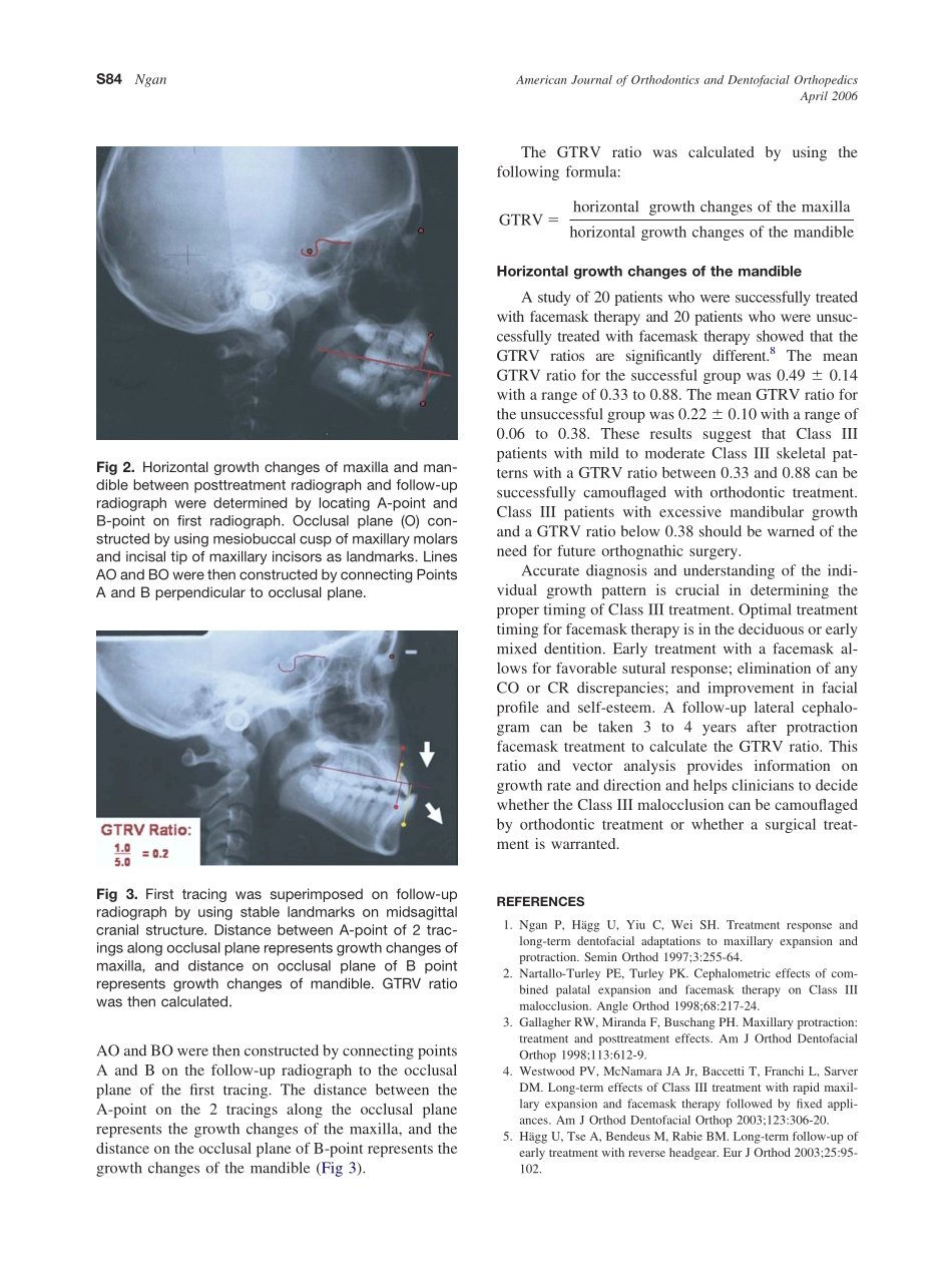 2006_129_4-Suppl-1_S82_S85_Ngan.pdf_第3页