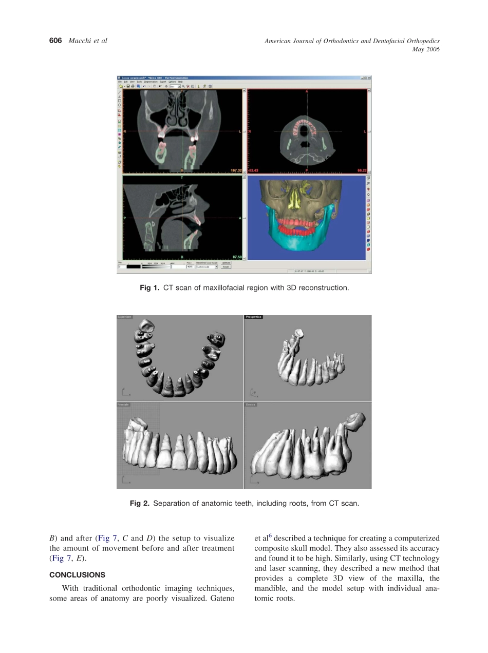 2006_129_5_605_610_Macchi.pdf_第2页