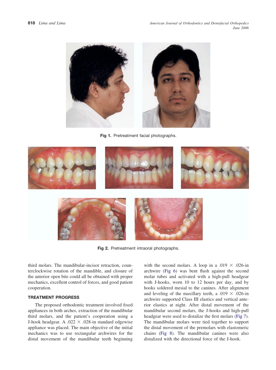 2006_129_6_817_824_Lima.pdf_第2页