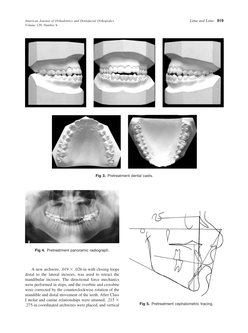 2006_129_6_817_824_Lima.pdf_第3页