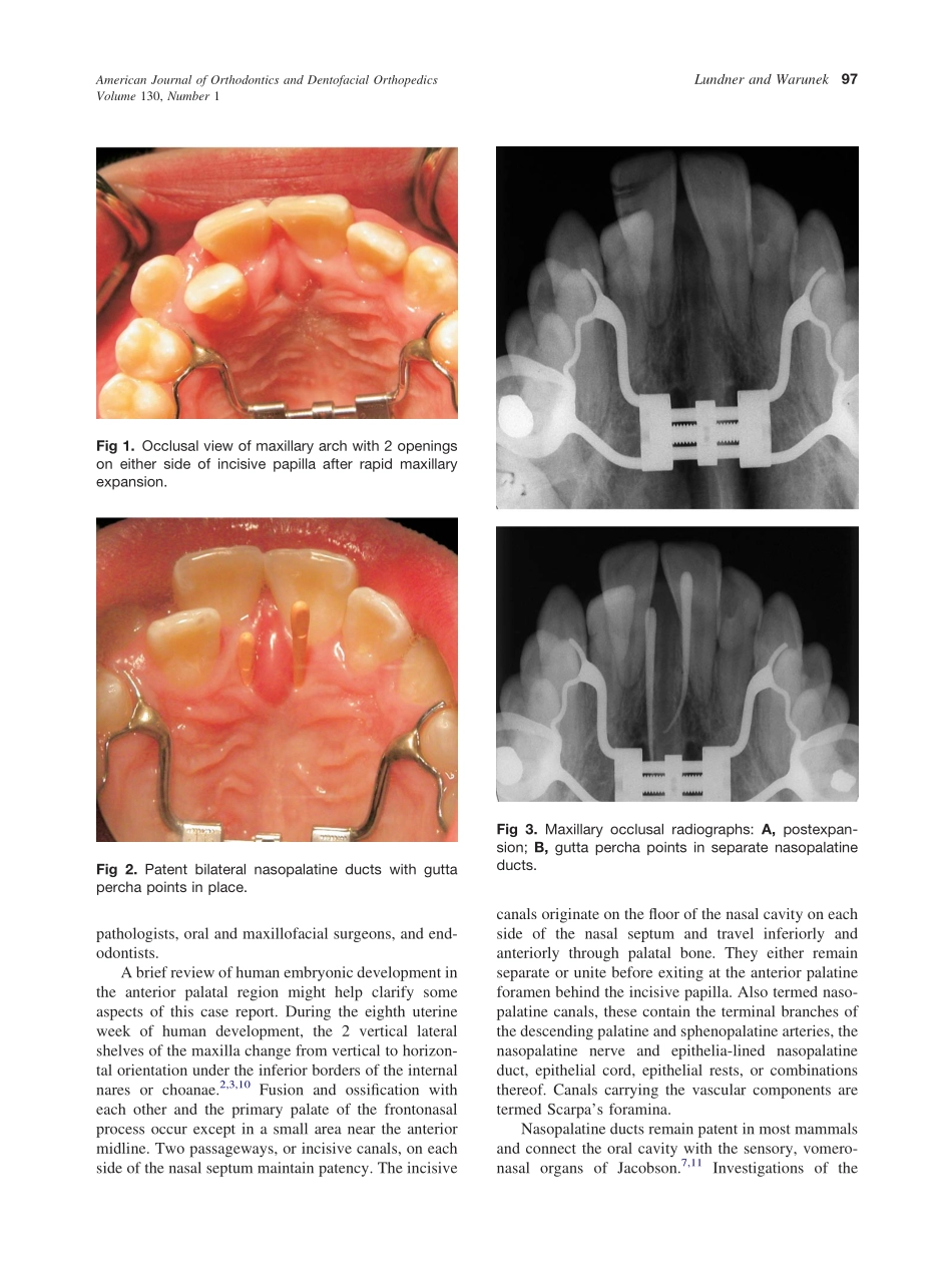 2006_130_1_96_99_Lundner.pdf_第2页