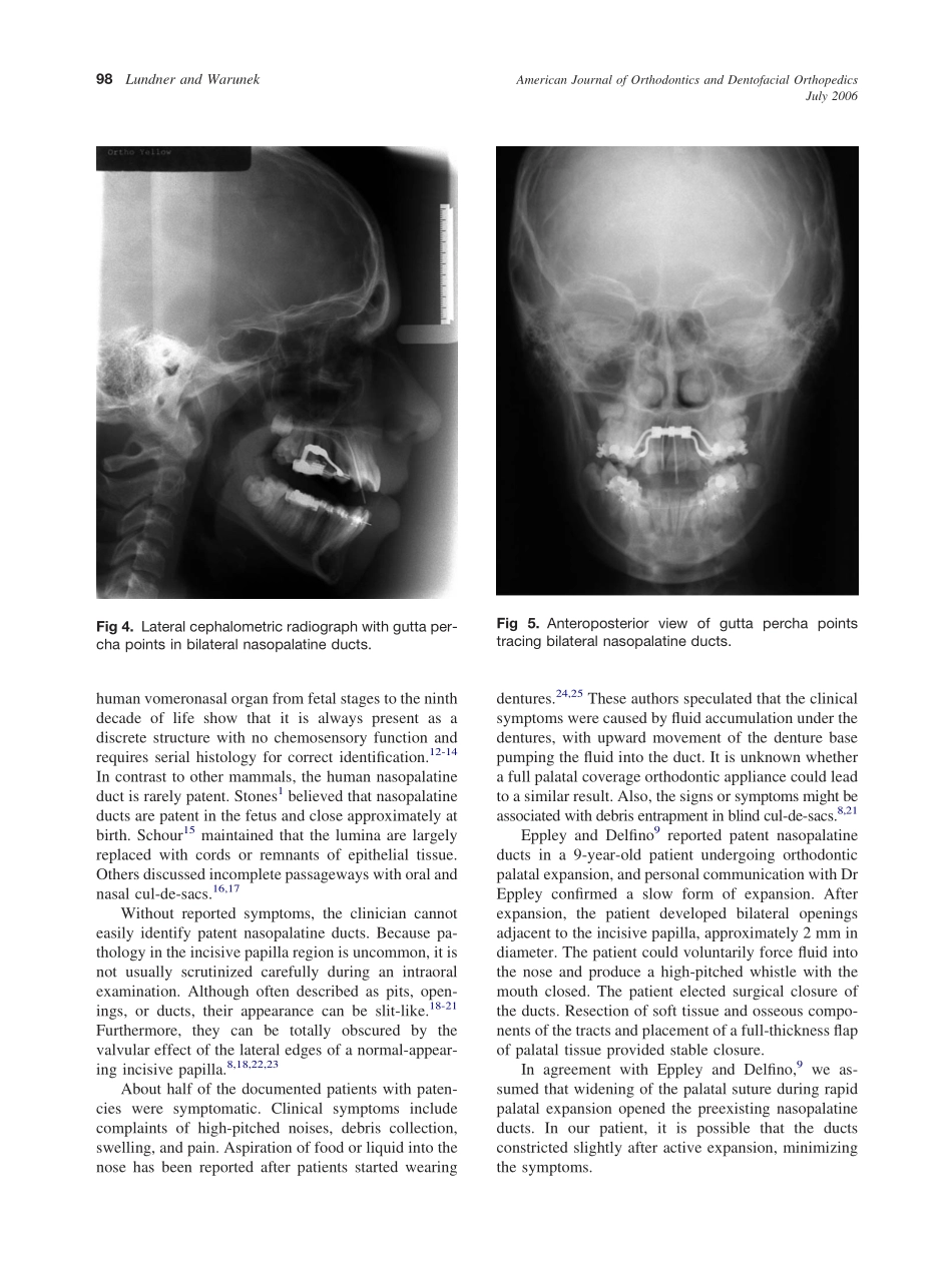 2006_130_1_96_99_Lundner.pdf_第3页