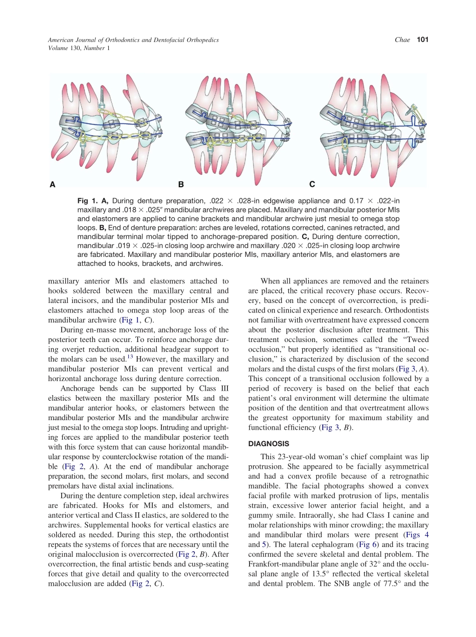 2006_130_1_100_109_Chae.pdf_第2页