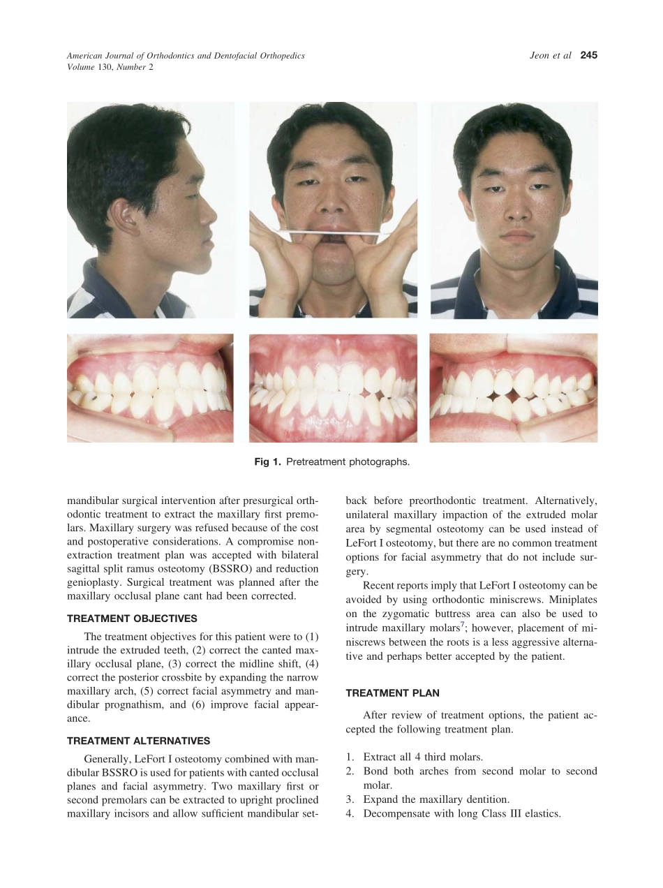 2006_130_2_244_252_Jeon.pdf_第2页
