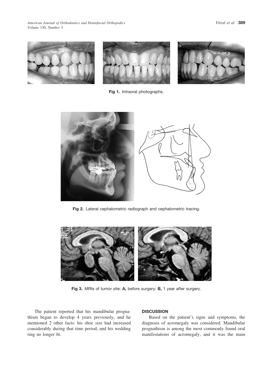 2006_130_3_388_390_Vitral.pdf_第2页