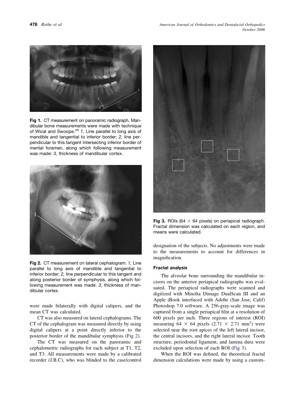 2006_130_4_476_484_Rothe.pdf_第3页