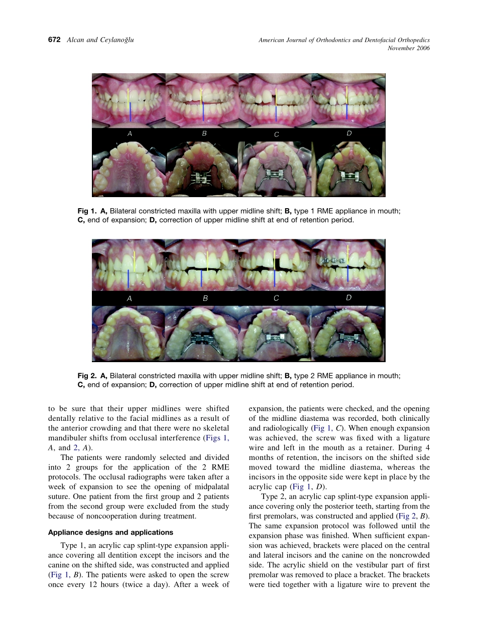 2006_130_5_671_675_Alcan.pdf_第2页